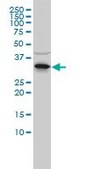 Monoclonal Anti-RNASEH2A antibody produced in mouse clone 3G5-F5, purified immunoglobulin, buffered aqueous solution