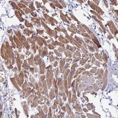 Anti-WDR83 antibody produced in rabbit Prestige Antibodies® Powered by Atlas Antibodies, affinity isolated antibody, buffered aqueous glycerol solution