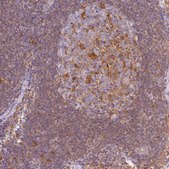 Anti-GPX1 antibody produced in rabbit Prestige Antibodies® Powered by Atlas Antibodies, affinity isolated antibody, buffered aqueous glycerol solution