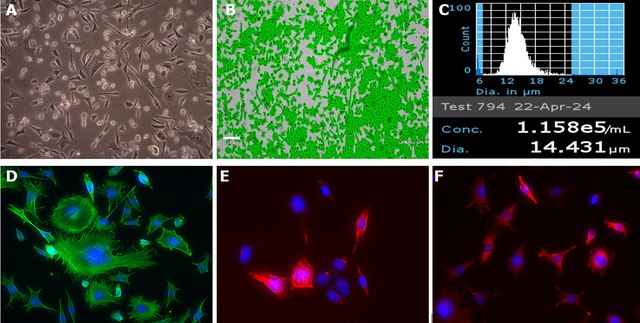 MEF SQSTM1 G427R Cell Line