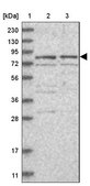 Anti-POLH antibody produced in rabbit Prestige Antibodies® Powered by Atlas Antibodies, affinity isolated antibody, buffered aqueous glycerol solution