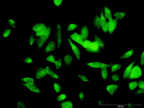 Anti-ME1 antibody produced in rabbit purified immunoglobulin, buffered aqueous solution