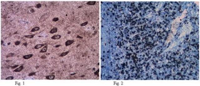 Anti-VPAC2 Antibody from rabbit, purified by affinity chromatography