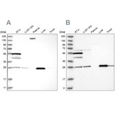 Anti-PNPO antibody produced in rabbit Prestige Antibodies® Powered by Atlas Antibodies, affinity isolated antibody, buffered aqueous glycerol solution