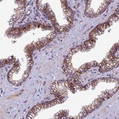 Anti-TSPAN15 antibody produced in rabbit Prestige Antibodies® Powered by Atlas Antibodies, affinity isolated antibody, buffered aqueous glycerol solution