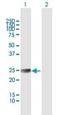 Anti-ETHE1 antibody produced in mouse IgG fraction of antiserum, buffered aqueous solution