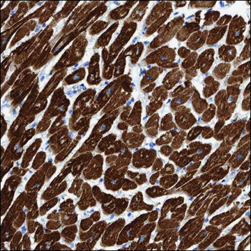 Anti-KRIT1 antibody produced in rabbit Prestige Antibodies&#174; Powered by Atlas Antibodies, affinity isolated antibody, buffered aqueous glycerol solution