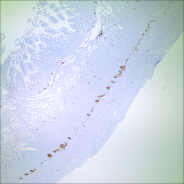 PGP 9.5 Rabbit Polyclonal Antibody