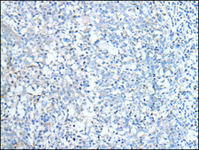 Anti-ABCD1 affinity isolated antibody