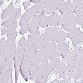 Anti-CASP14 antibody produced in rabbit Prestige Antibodies® Powered by Atlas Antibodies, affinity isolated antibody, buffered aqueous glycerol solution