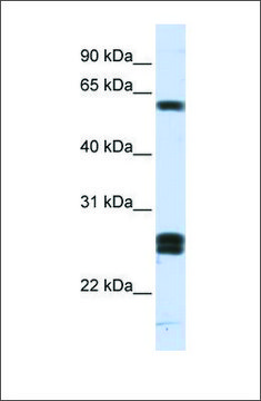 Anti-HABP2 antibody produced in rabbit affinity isolated antibody