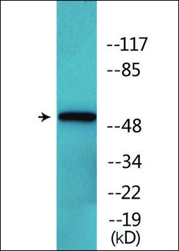 Anti-phospho-Keratin 8 (pSer432) antibody produced in rabbit affinity isolated antibody