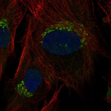 Anti-Tnfrsf11B Antibody Produced In Rabbit Prestige Antibodies&#174; Powered by Atlas Antibodies, affinity isolated antibody, buffered aqueous glycerol solution