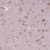 Anti-SERPINI1 antibody produced in rabbit Prestige Antibodies® Powered by Atlas Antibodies, affinity isolated antibody, buffered aqueous glycerol solution