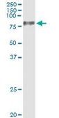 Monoclonal Anti-UMOD antibody produced in mouse clone 3F10, purified immunoglobulin, buffered aqueous solution