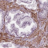 Anti-HAS1 antibody produced in rabbit Prestige Antibodies® Powered by Atlas Antibodies, affinity isolated antibody, buffered aqueous glycerol solution