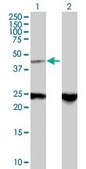 Anti-ZNF24 antibody produced in mouse purified immunoglobulin, buffered aqueous solution
