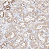 Anti-ATP6V1C1 antibody produced in rabbit Prestige Antibodies® Powered by Atlas Antibodies, affinity isolated antibody, buffered aqueous glycerol solution, Ab1