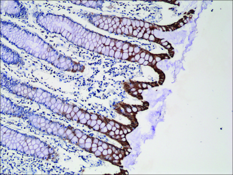 Anti-Cytokeratin-20 antibody, Rabbit Monoclonal recombinant, expressed in HEK 293 cells, clone RM283, purified immunoglobulin