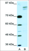Anti-GTF2I antibody produced in rabbit affinity isolated antibody