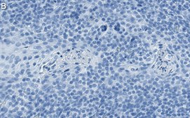 Anti-MCL-1 Antibody, clone 2O7 ZooMAb® Rabbit Monoclonal recombinant, expressed in HEK 293 cells