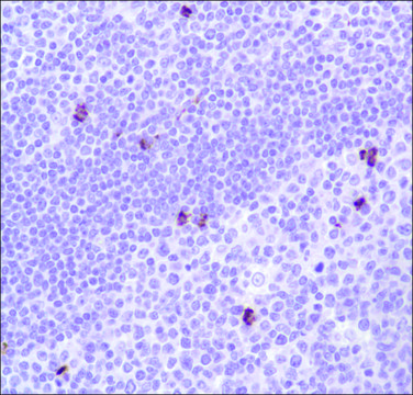 Anti-Myeloperoxidase antibody, Rabbit monoclonal recombinant, expressed in proprietary host, clone SP72, affinity isolated antibody