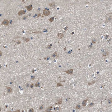 Anti-SARS antibody produced in rabbit Prestige Antibodies&#174; Powered by Atlas Antibodies, affinity isolated antibody, buffered aqueous glycerol solution