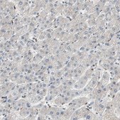 Anti-POLH antibody produced in rabbit Prestige Antibodies® Powered by Atlas Antibodies, affinity isolated antibody, buffered aqueous glycerol solution