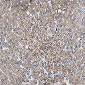 Anti-ETFA antibody produced in rabbit Prestige Antibodies® Powered by Atlas Antibodies, affinity isolated antibody, buffered aqueous glycerol solution