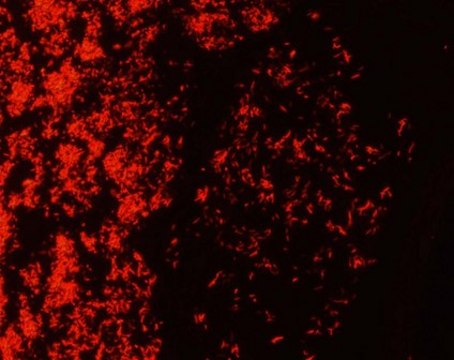 AFB-Fluor phenol-free Staining kit for the examination of acid-fast bacteria with fluorescence microscopy (Auramin-Rhodamine staining)