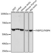 Anti-FKBP52/FKBP4 Antibody, clone 3Q6H2, Rabbit Monoclonal