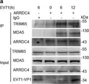 Anti-TRIM65 antibody produced in rabbit Prestige Antibodies® Powered by Atlas Antibodies, affinity isolated antibody, buffered aqueous glycerol solution, Ab2