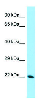 Anti-CDNF (N-terminal) antibody produced in rabbit affinity isolated antibody