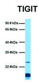 Anti-TIGIT (C-terminal) antibody produced in rabbit affinity isolated antibody