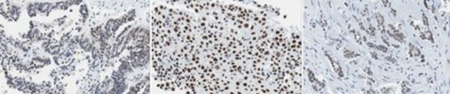 Anti-SMARCA3 (HLTF) Antibody, clone 5-1 clone 5-1, from mouse