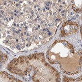 Anti-SCO1 antibody produced in rabbit Prestige Antibodies® Powered by Atlas Antibodies, affinity isolated antibody, buffered aqueous glycerol solution, Ab2