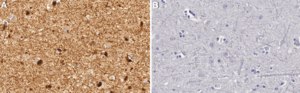Anti-DCTN1 Antibody, clone 2B11 ZooMAb® Rabbit Monoclonal recombinant, expressed in HEK 293 cells