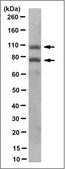 Anti-Sp100 Antibody, clone 2H1.1 clone 2H1.1, from mouse