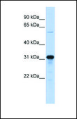 Anti-HOXA5 antibody produced in rabbit affinity isolated antibody