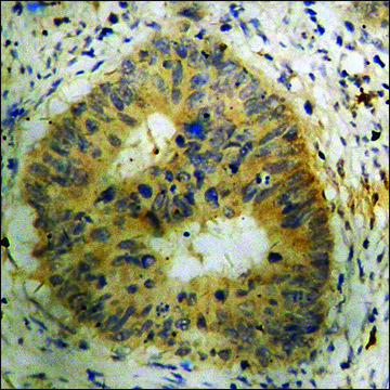 Anti-phospho-ASK1 (pSer83) antibody produced in rabbit affinity isolated antibody