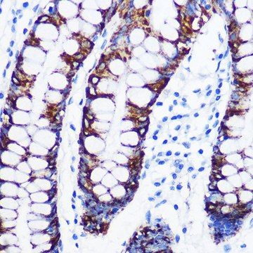 Anti-Monoamine Oxidase A (MAOA) antibody produced in rabbit