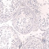 Monoclonal Anti-Tnnt2 Antibody Produced In Mouse Prestige Antibodies® Powered by Atlas Antibodies, clone CL13382, affinity isolated antibody, buffered aqueous glycerol solution