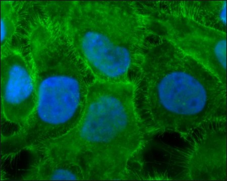 Anti-Ezrin antibody produced in rabbit affinity isolated antibody, buffered aqueous solution