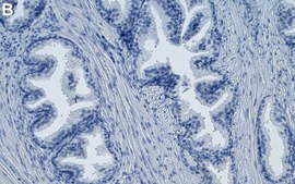 Anti-Filamin A Antibody, clone PM6/317 ZooMAb® Mouse Monoclonal recombinant, expressed in HEK 293 cells