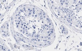 Anti-TFE3 Antibody, clone 1G5 ZooMAb® Rabbit Monoclonal recombinant, expressed in HEK 293 cells