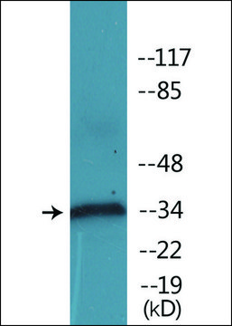 抗-磷酸化-CD32 (pTyr292) 兔抗 affinity isolated antibody