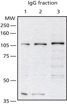 Anti-O-GlcNAc Transferase (TI-14) antibody produced in rabbit IgG fraction of antiserum, buffered aqueous solution