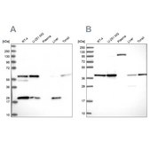Anti-SAE1 antibody produced in rabbit Prestige Antibodies® Powered by Atlas Antibodies, affinity isolated antibody, buffered aqueous glycerol solution