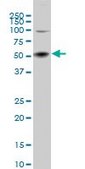 Monoclonal Anti-SGK2 antibody produced in mouse clone 2F6, purified immunoglobulin, buffered aqueous solution