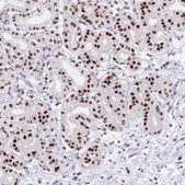 Anti-NFIC antibody produced in rabbit Prestige Antibodies® Powered by Atlas Antibodies, affinity isolated antibody, buffered aqueous glycerol solution